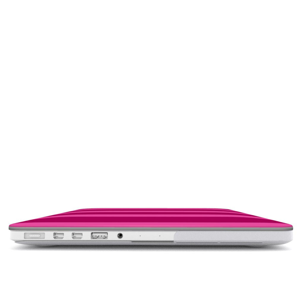 Blush - MacBook Case