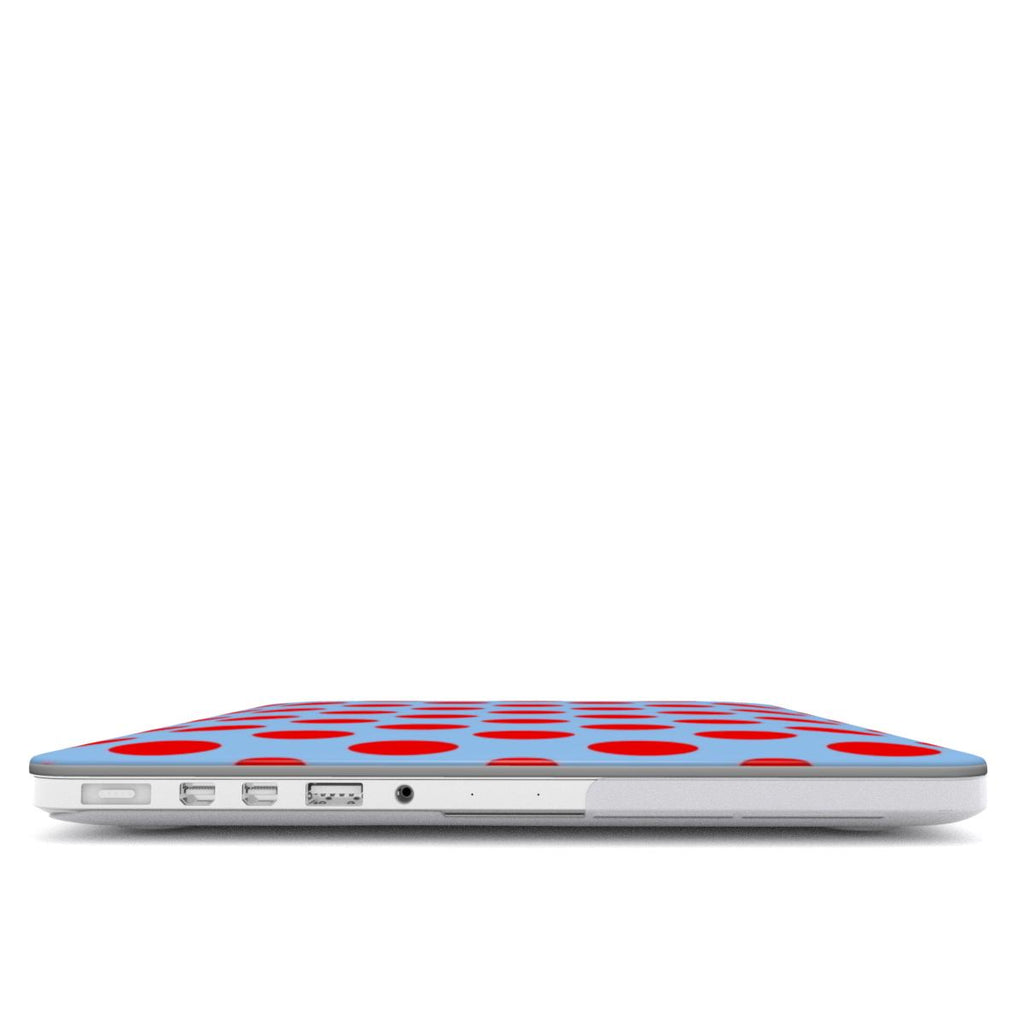 Candy - MacBook Case