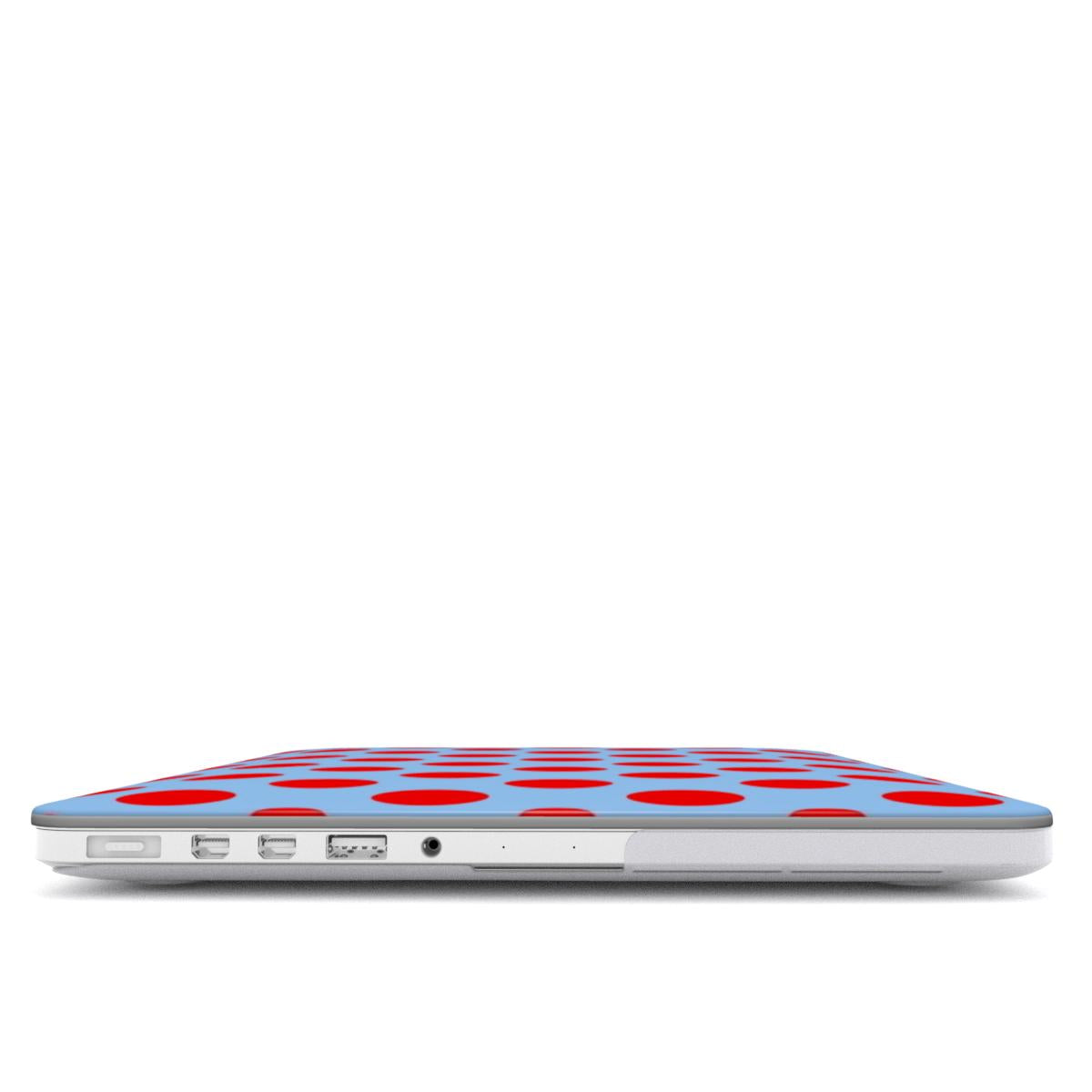 Candy - MacBook Case