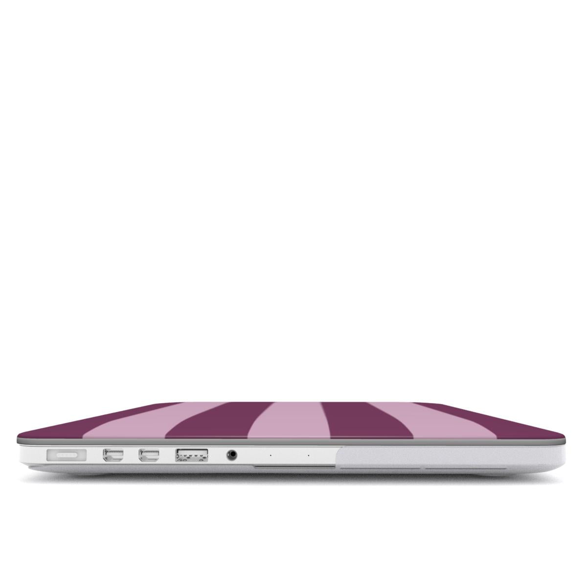 Sweet Pop - MacBook Case