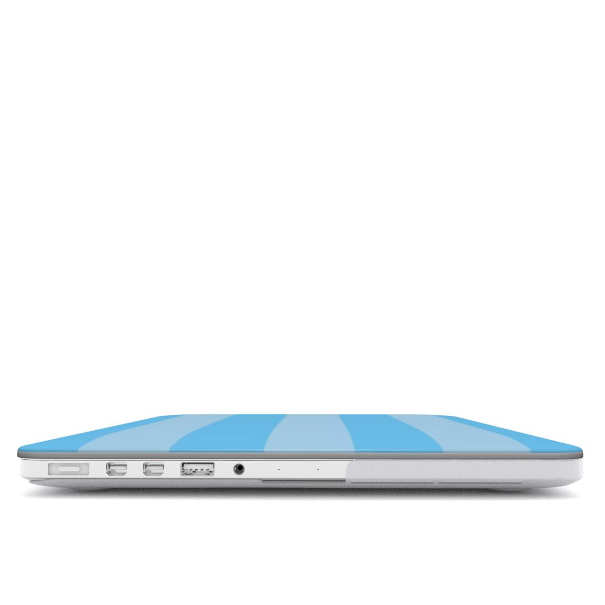 Sugar - MacBook Case