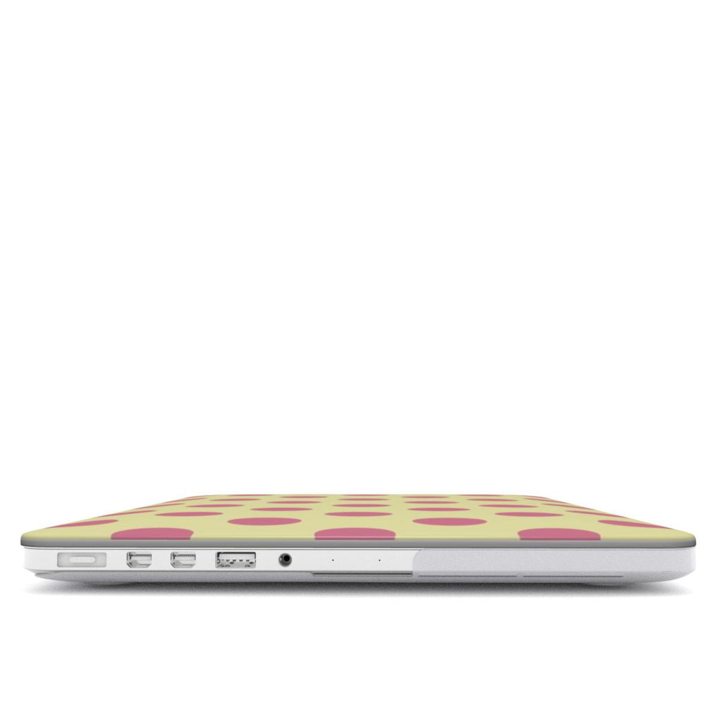 Dreamy - MacBook Case