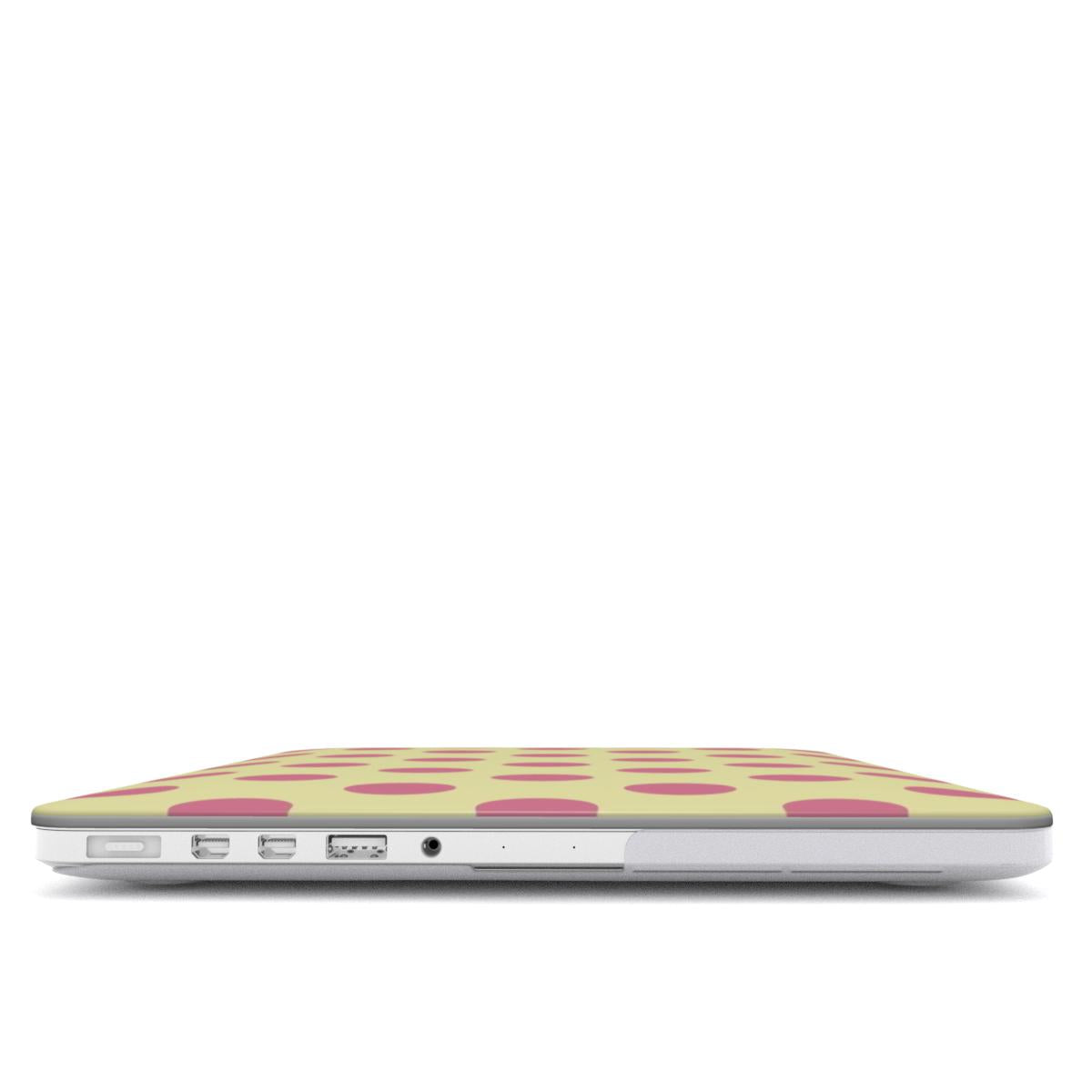 Dreamy - MacBook Case