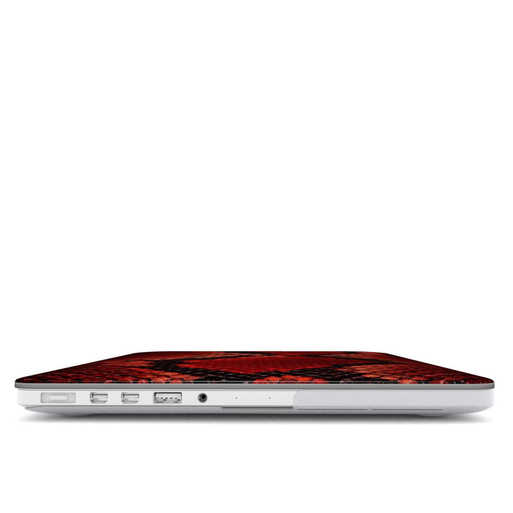 Ruby - MacBook Case