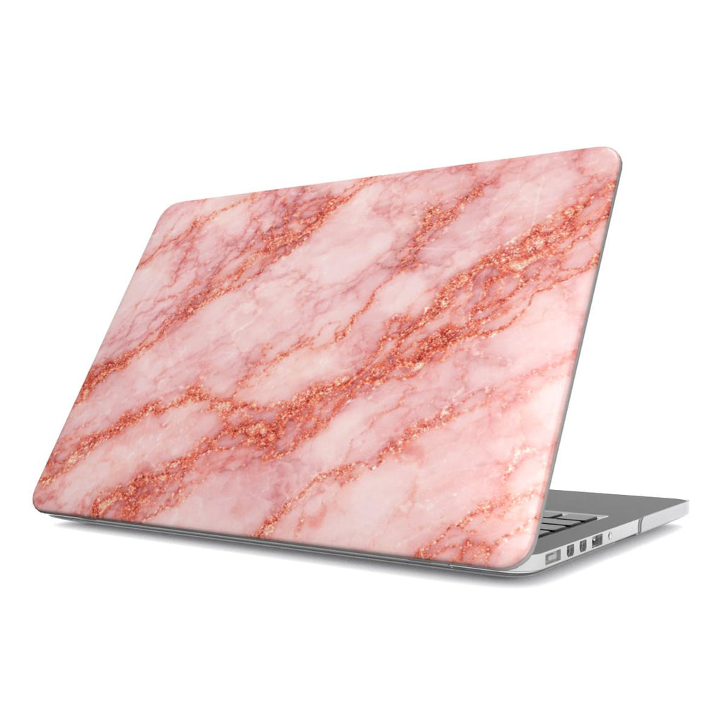 Aurora - MacBook Case