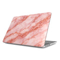 Aurora - MacBook Case