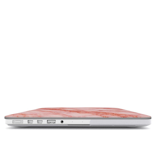 Aurora - MacBook Case