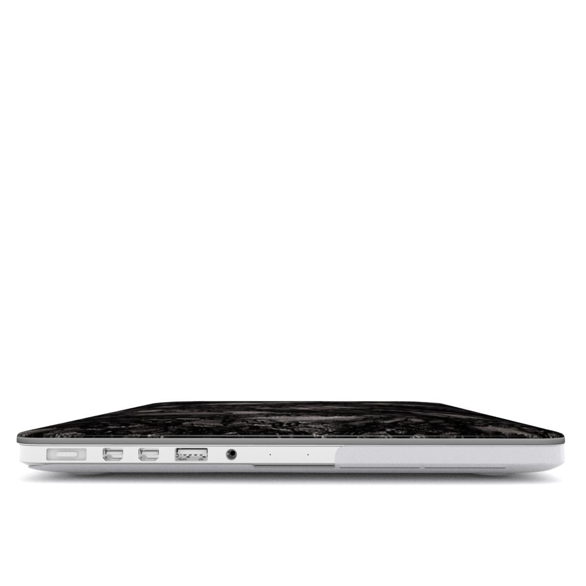 Sexy - MacBook Case