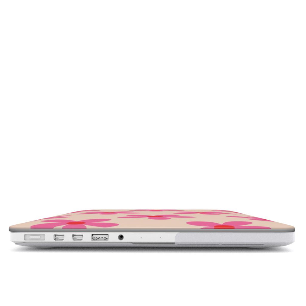 Garden - MacBook Case