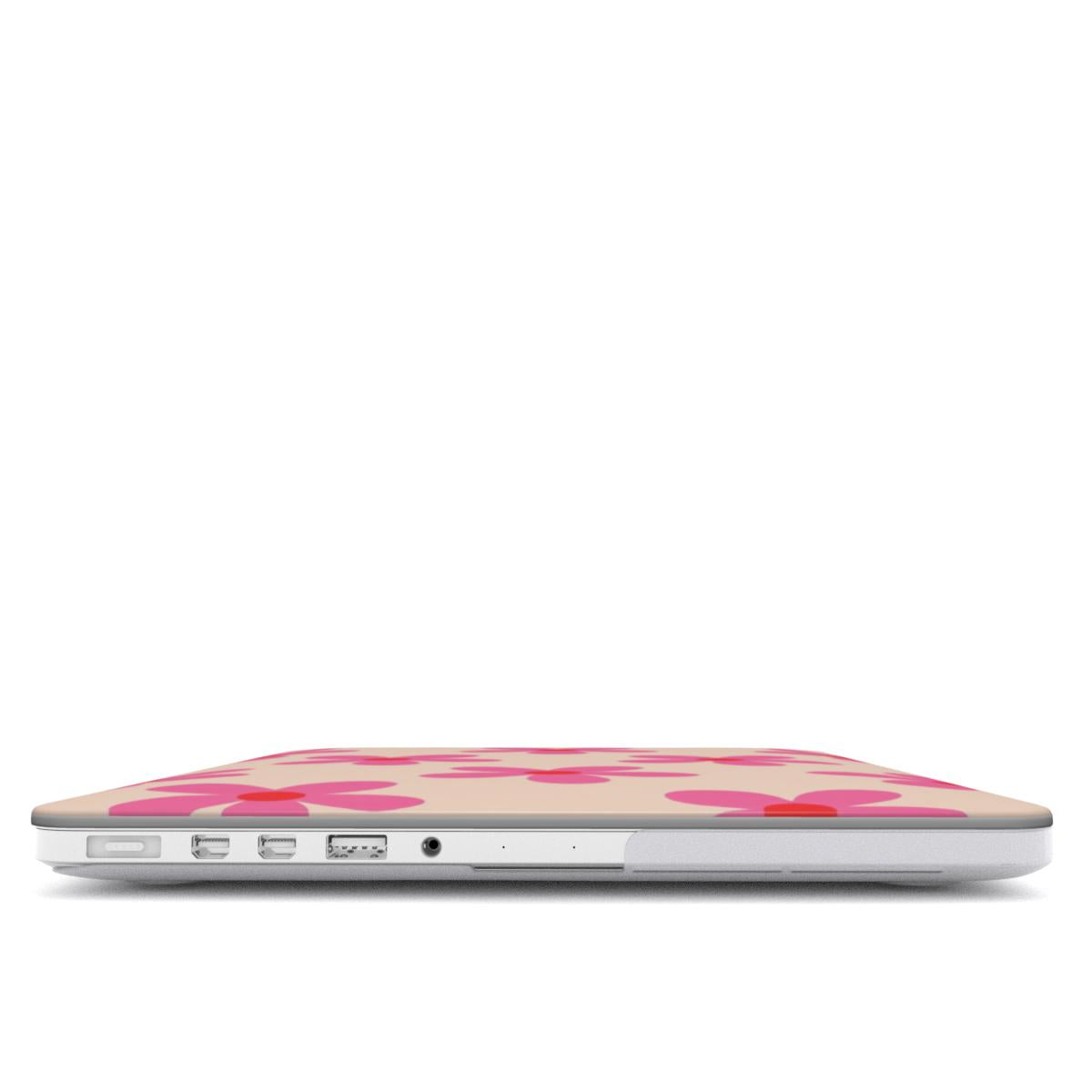 Garden - MacBook Case