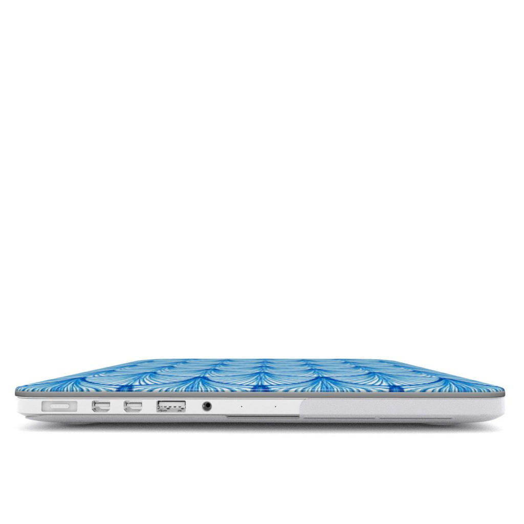 Azure - MacBook Case
