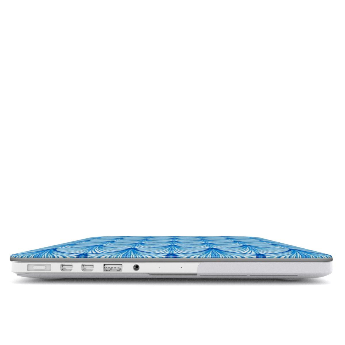 Azure - MacBook Case