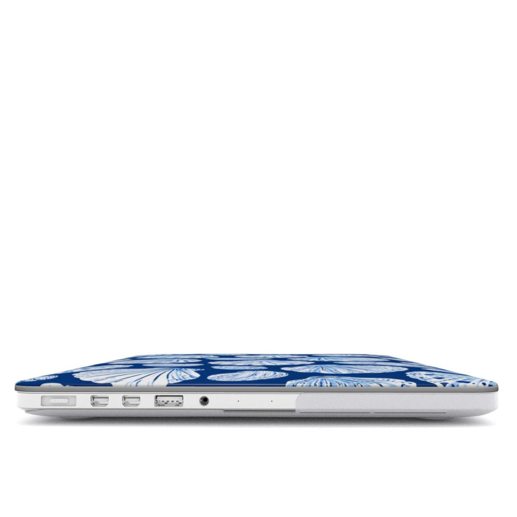 Shell - MacBook Case