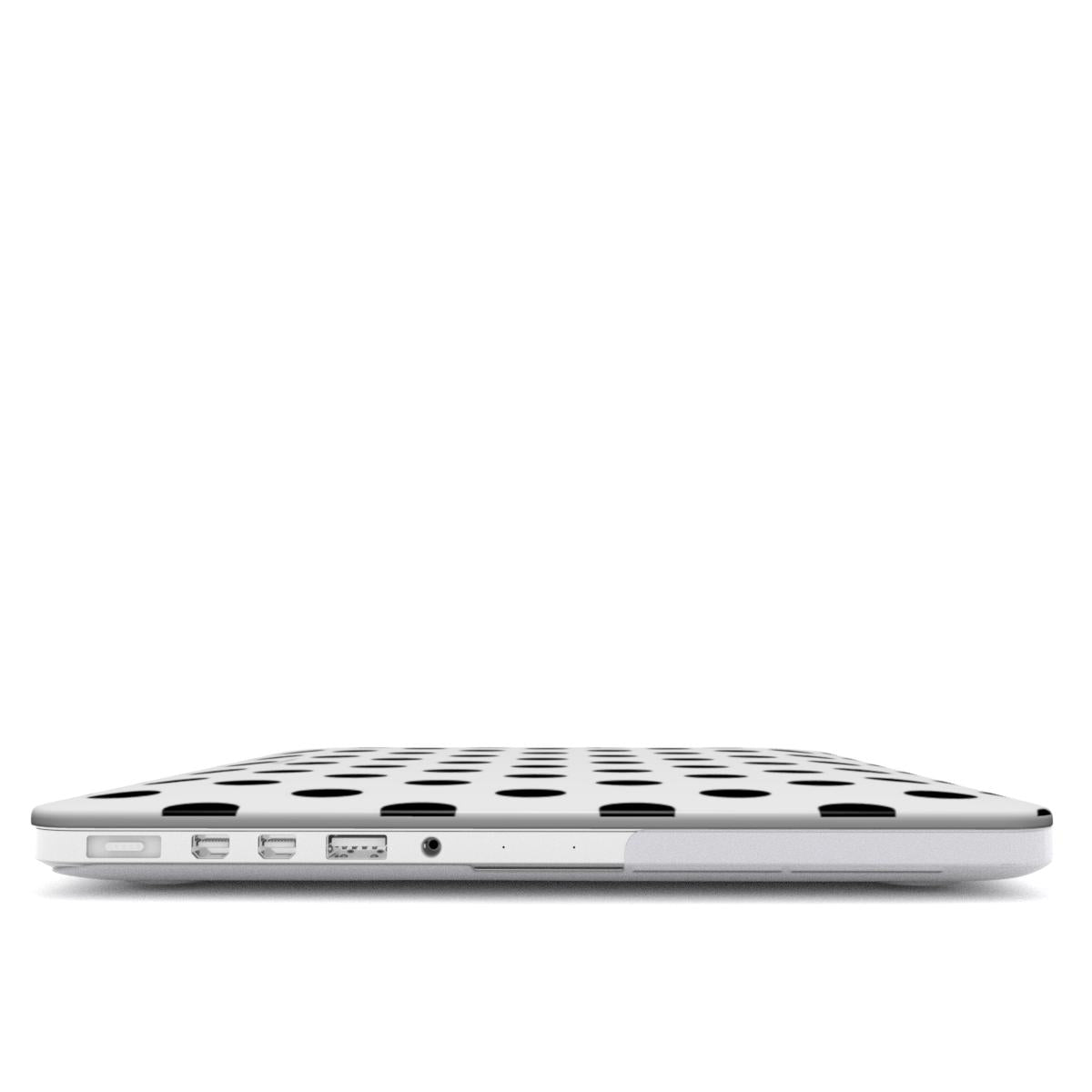 Coquette - MacBook Case