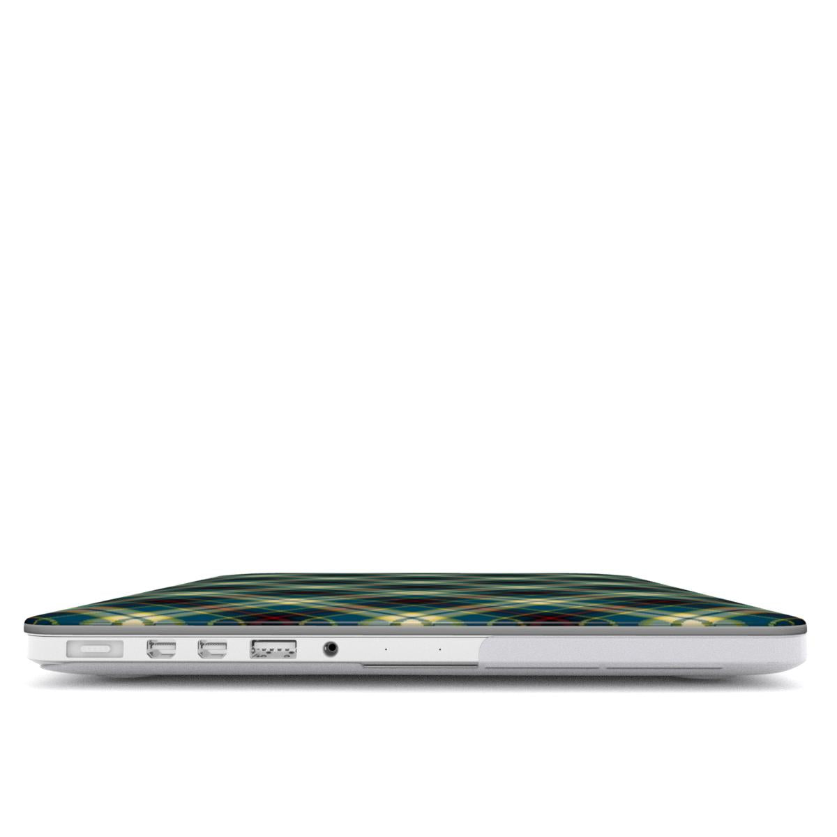 Tartan - MacBook Case