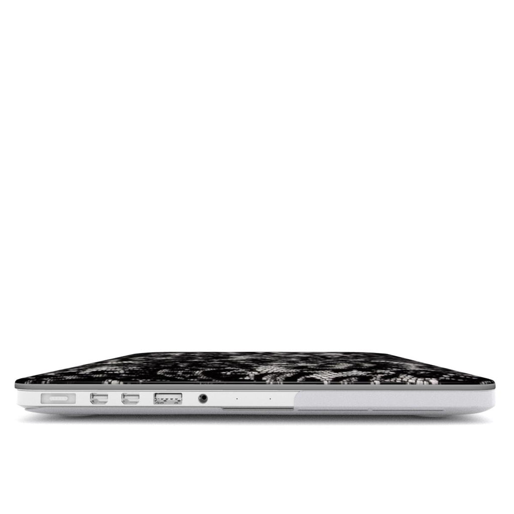 Eternal - MacBook Case