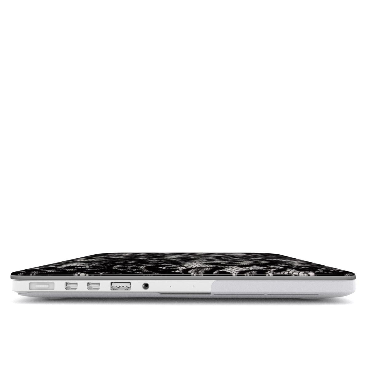 Eternal - MacBook Case