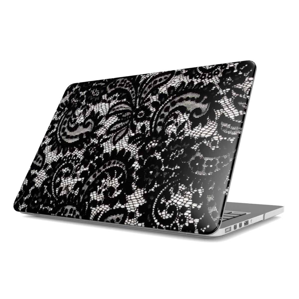 Eternal - MacBook Case