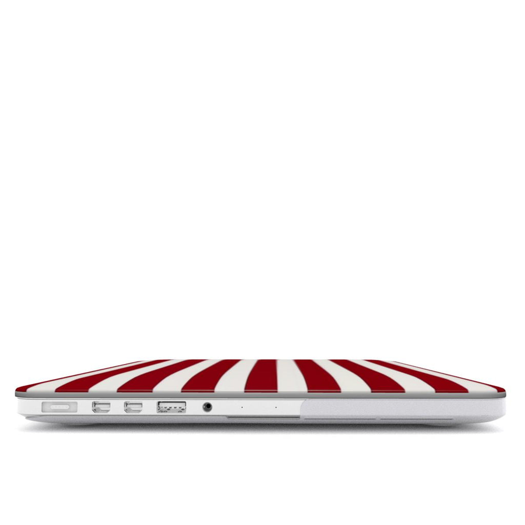 Circus - MacBook Case