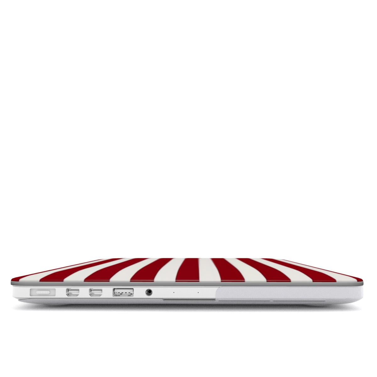 Circus - MacBook Case
