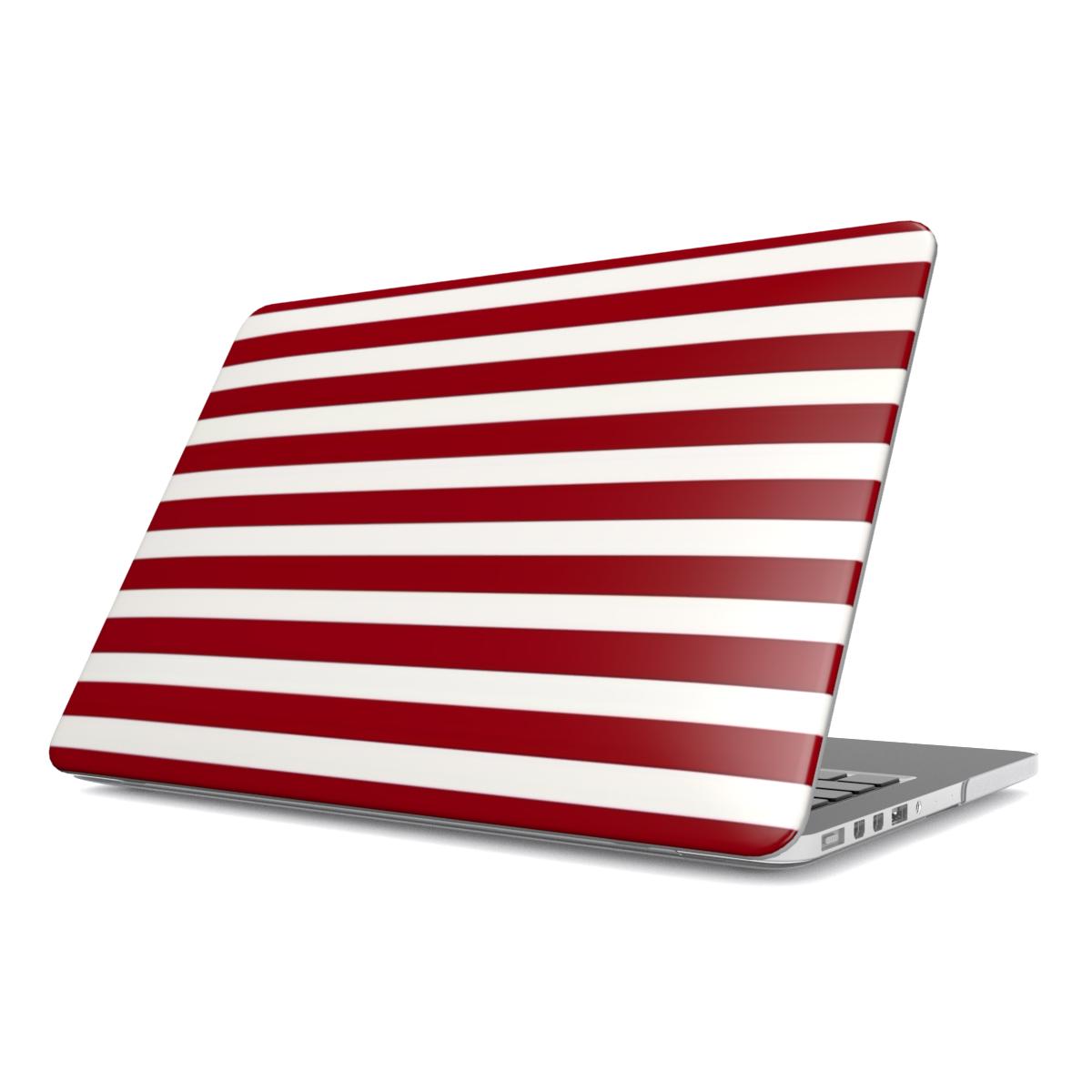 Circus - MacBook Case