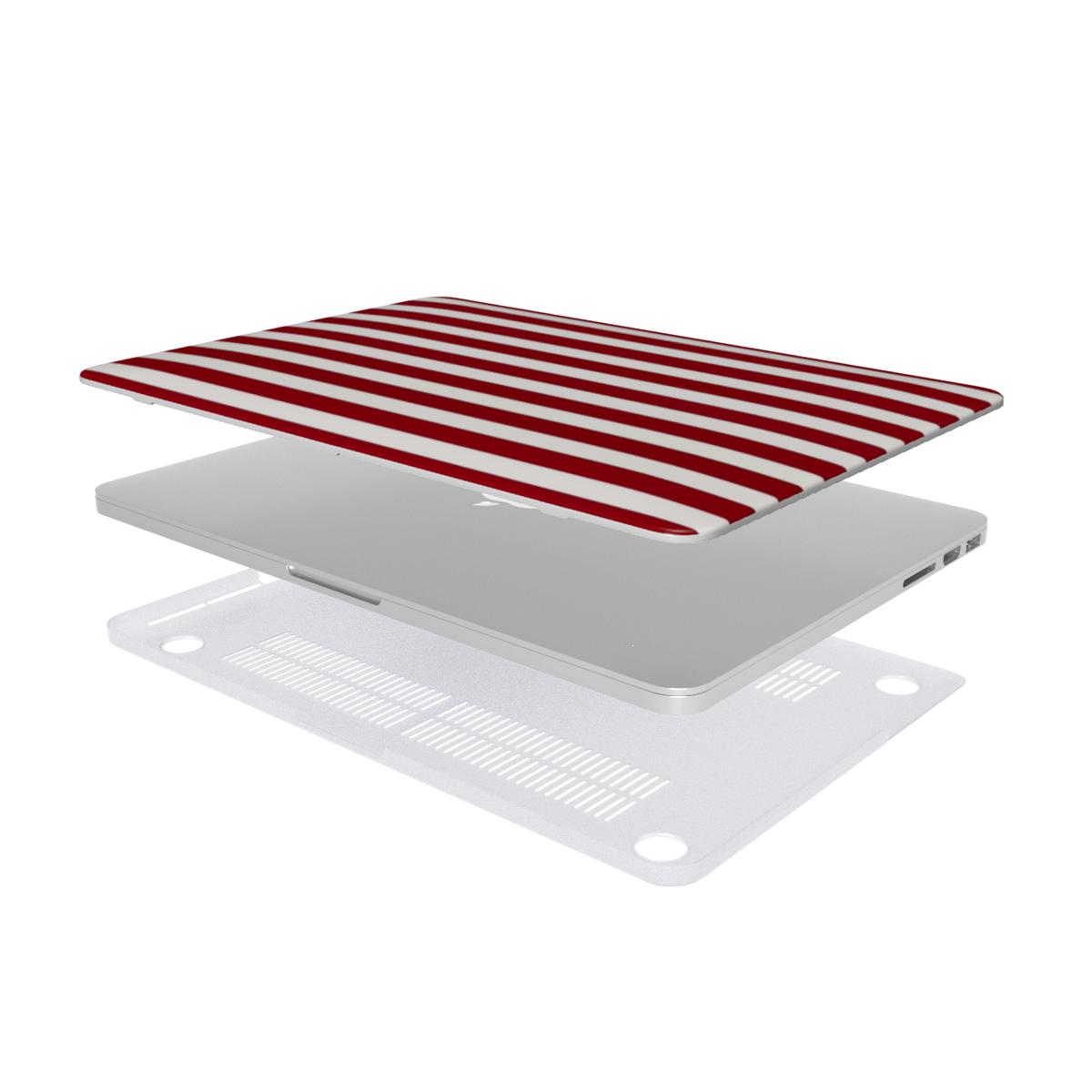 Circus - MacBook Case