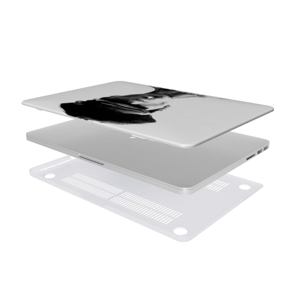 Hot - MacBook Case