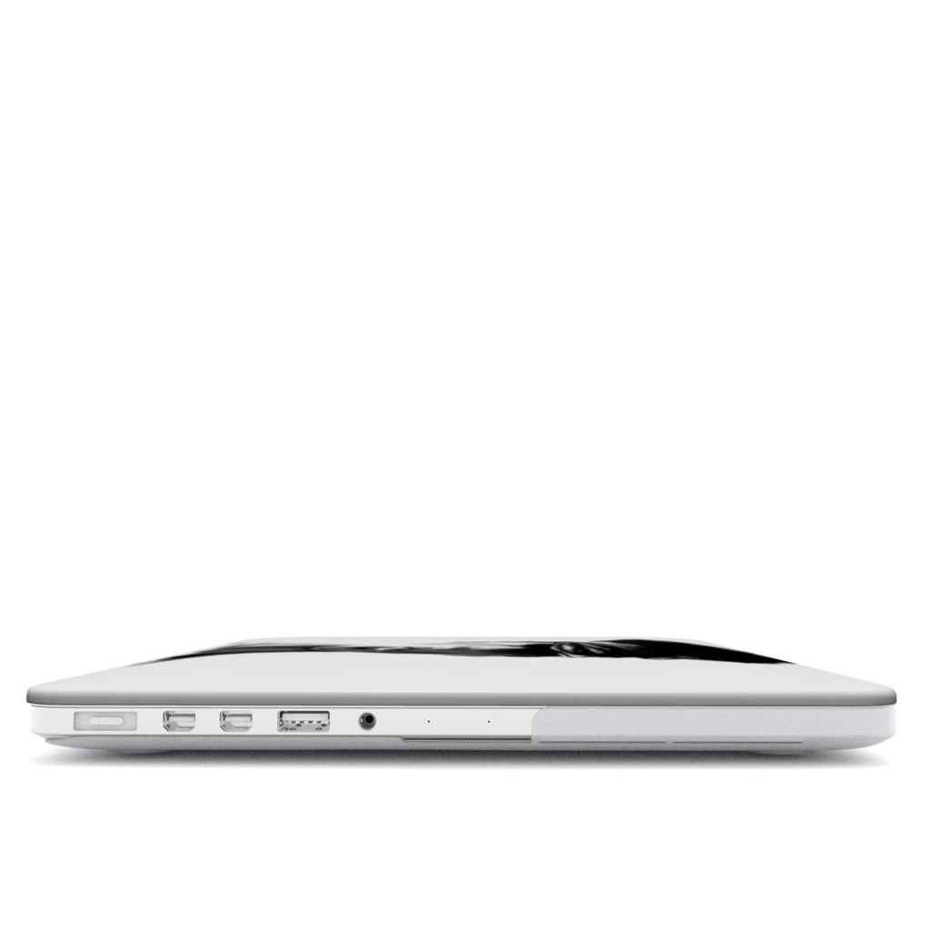 Hot - MacBook Case