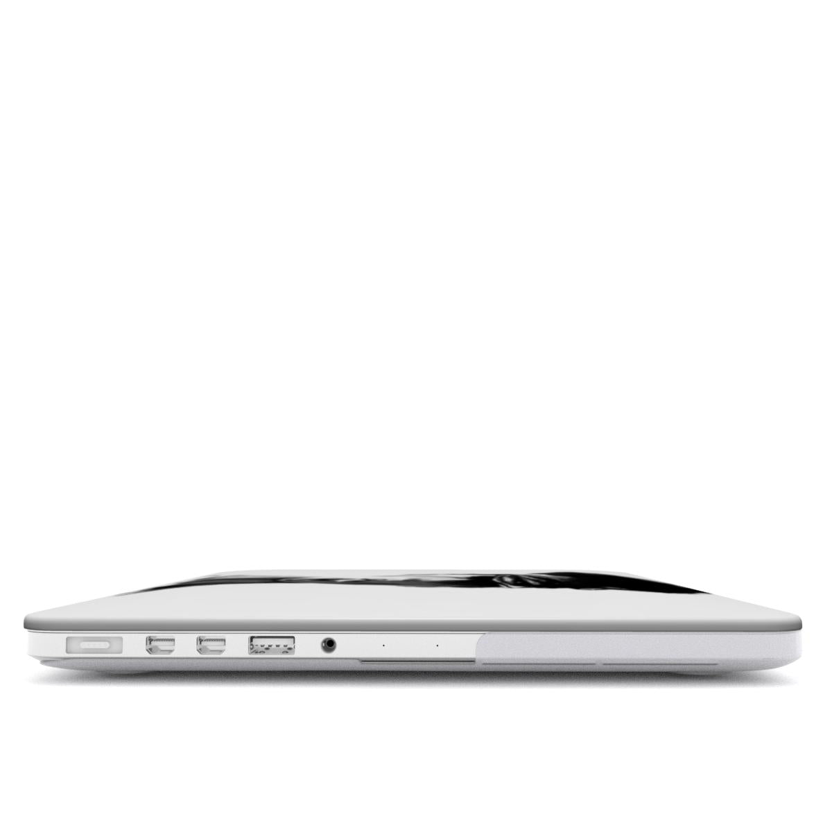 Hot - MacBook Case