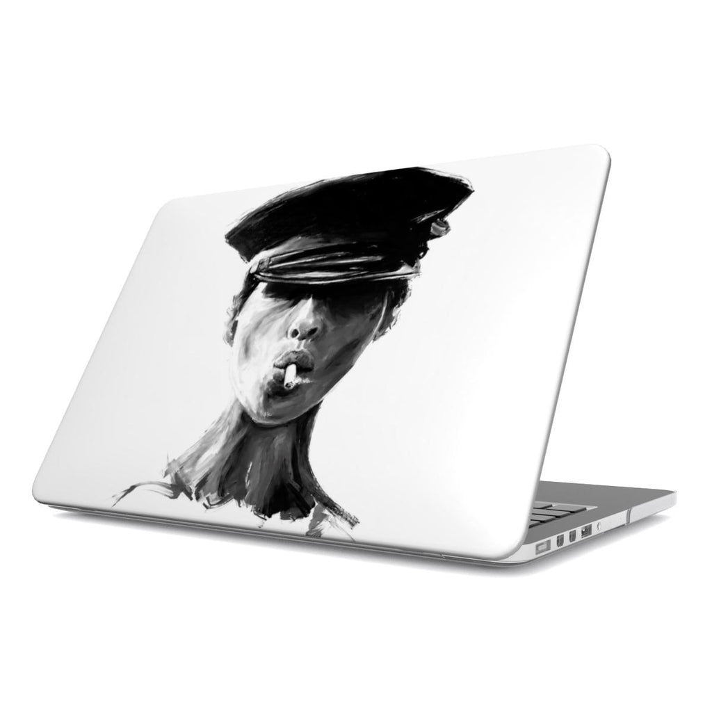 Hot - MacBook Case