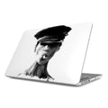 Hot - MacBook Case