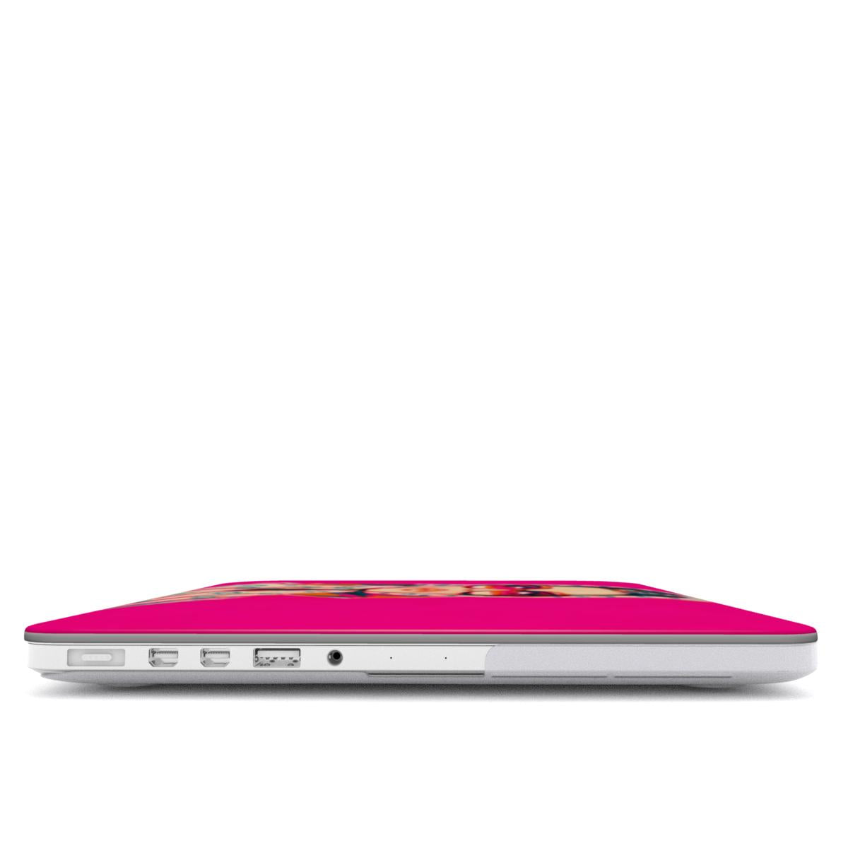 Muse - MacBook Case