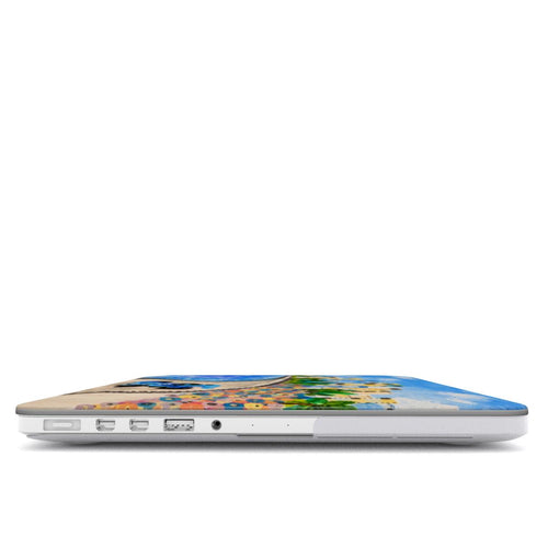 1 - MacBook Case