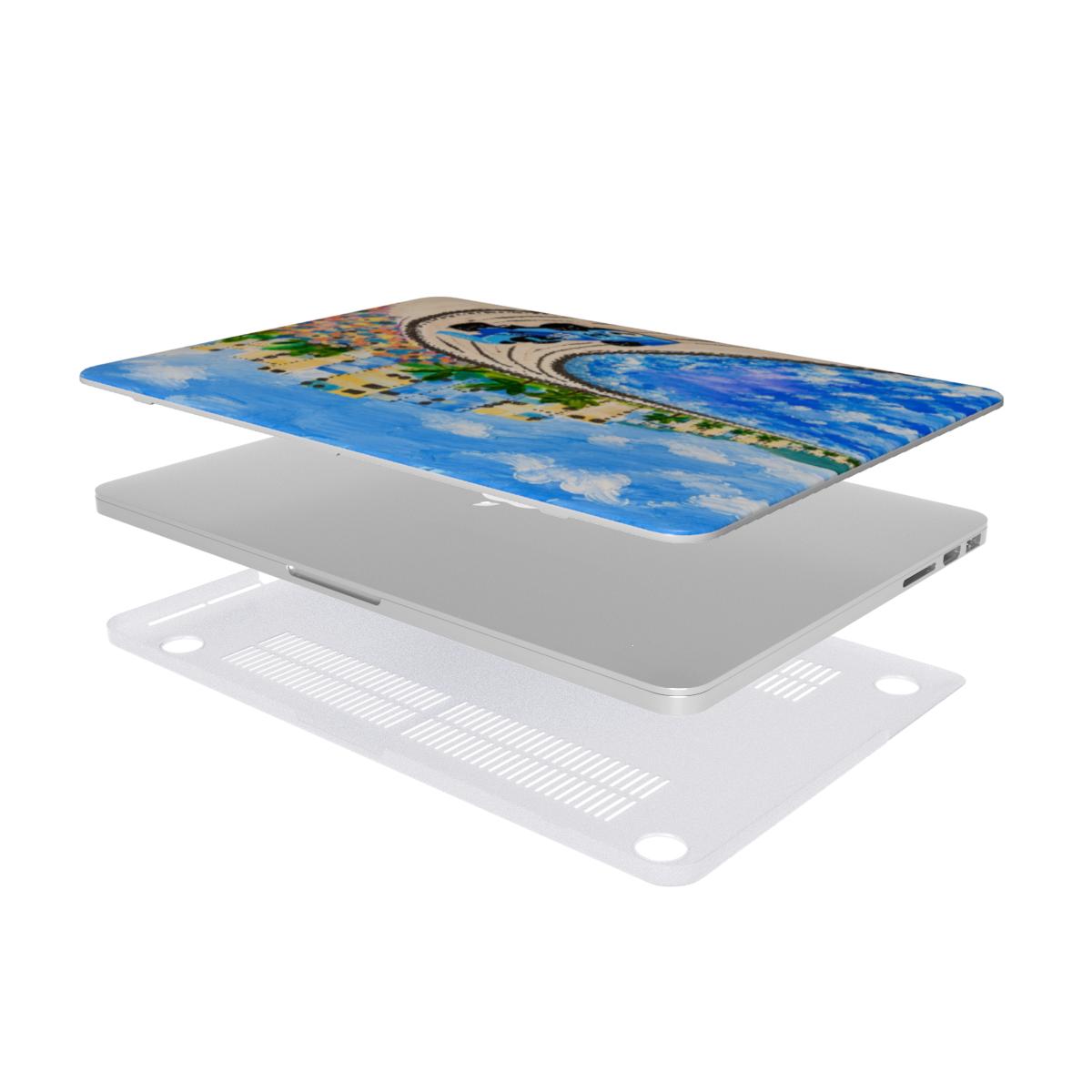 1 - MacBook Case
