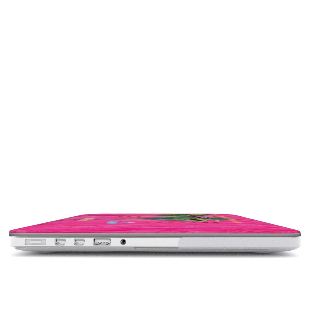 Palm - MacBook Case